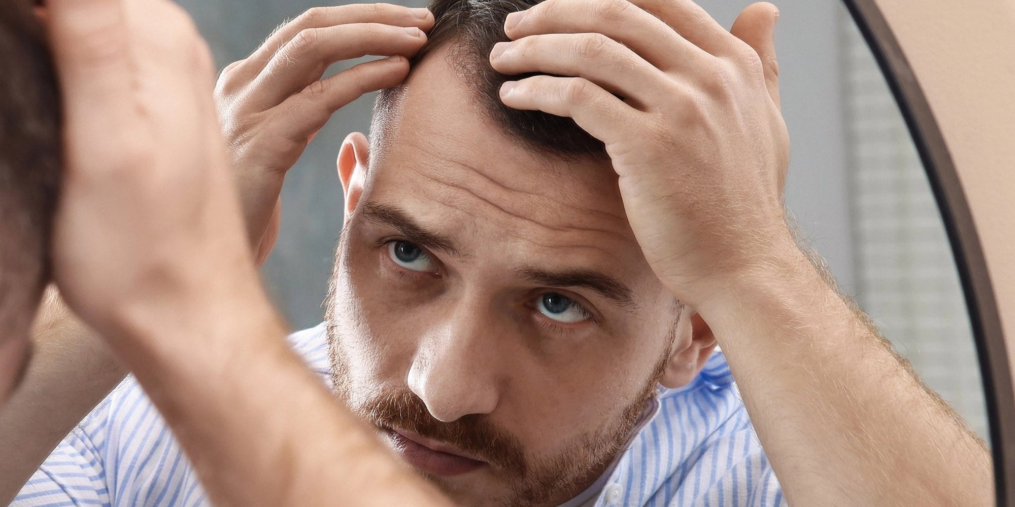 Is a hair system right for you? 5 questions to ask first